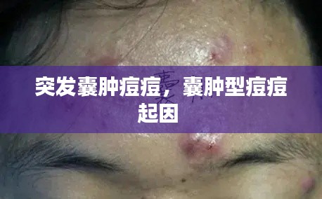 突发囊肿痘痘,囊肿型痘痘起因